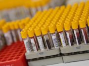 BRASIL REGISTRA 1.124 ÓBITOS PELA COVID-19; SÃO MAIS DE 20 MIL CASOS CONFIRMADOS DA DOENÇA NO PAÍS