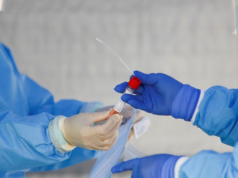 MINISTÉRIO DA SAÚDE CONFIRMA PRIMEIRO CASO DE REINFECÇÃO POR COVID-19 NO PAÍS